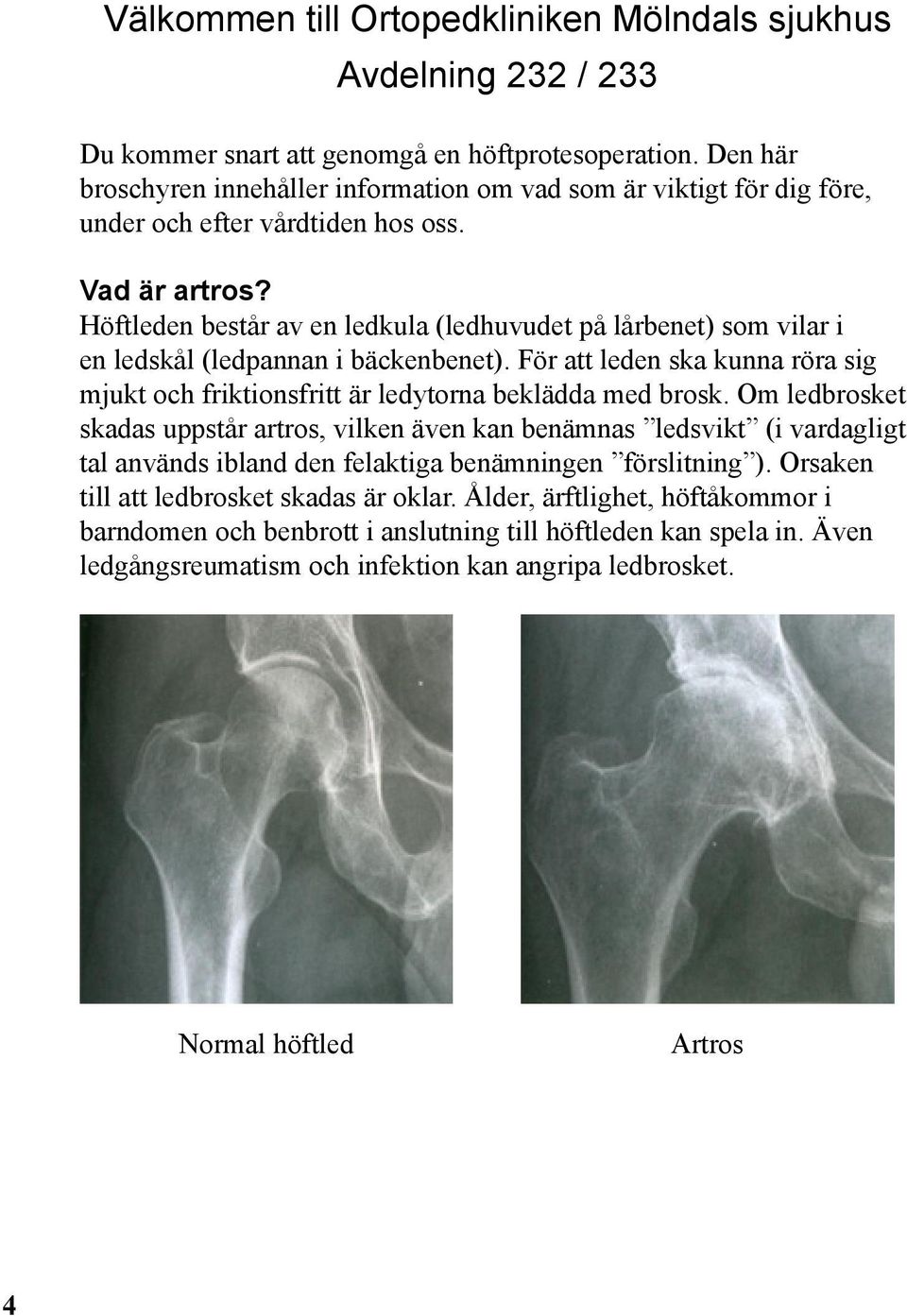 Höftleden består av en ledkula (ledhuvudet på lårbenet) som vilar i en ledskål (ledpannan i bäckenbenet). För att leden ska kunna röra sig mjukt och friktionsfritt är ledytorna beklädda med brosk.