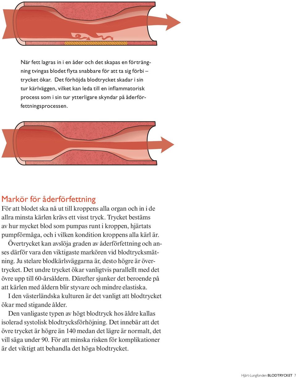 Markör för åderförfettning För att blodet ska nå ut till kroppens alla organ och in i de allra minsta kärlen krävs ett visst tryck.