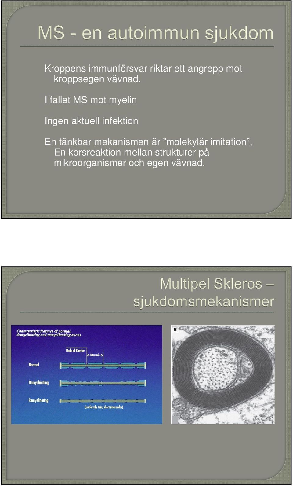 I fallet MS mot myelin Ingen aktuell infektion En