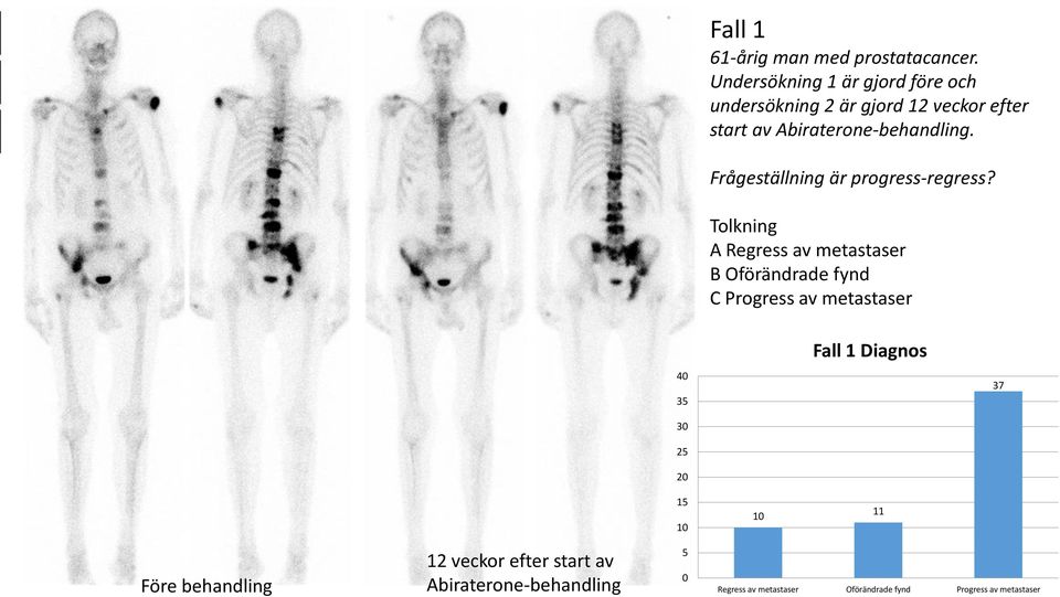 Frågeställning är progress-regress?