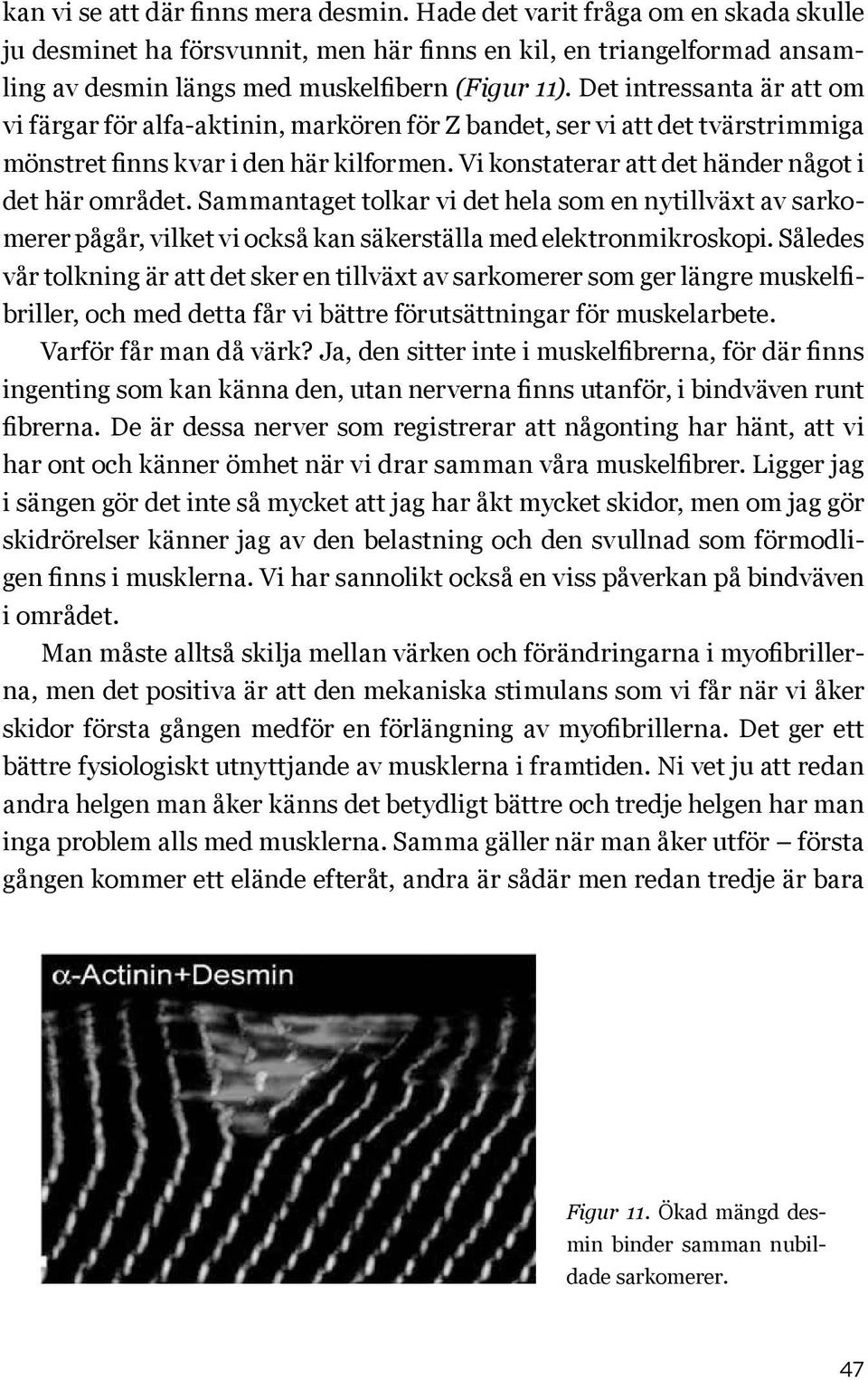 Vi konstaterar att det händer något i det här området. Sammantaget tolkar vi det hela som en nytillväxt av sarkomerer pågår, vilket vi också kan säkerställa med elektronmikroskopi.