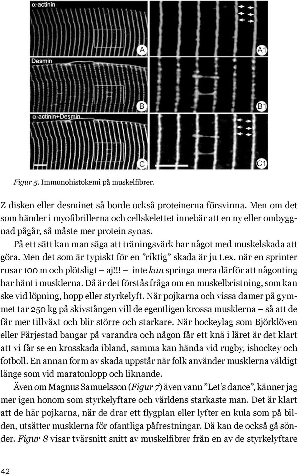 På ett sätt kan man säga att träningsvärk har något med muskelskada att göra. Men det som är typiskt för en riktig skada är ju t.ex. när en sprinter rusar 100 m och plötsligt aj!