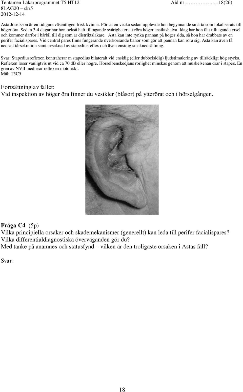 Asta kan inte rynka pannan på höger sida, så hon har drabbats av en perifer facialispares. Vid central pares finns fungerande överkorsande banor som gör att pannan kan röra sig.