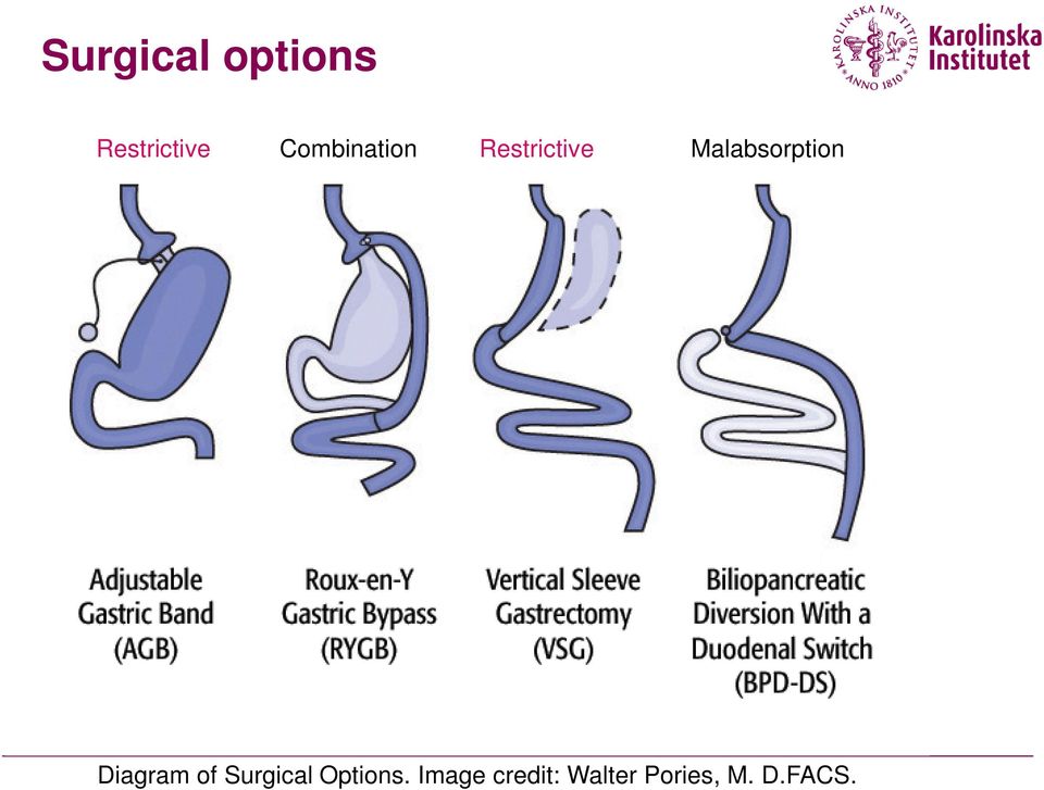 Malabsorption Diagram of Surgical