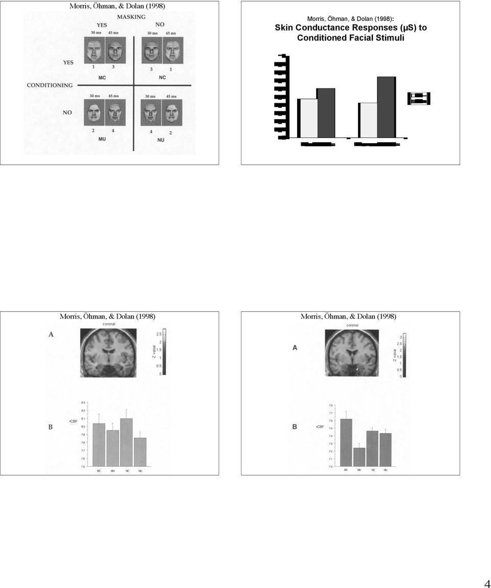 (µs) to Conditioned Facial Stimuli  & Dolan