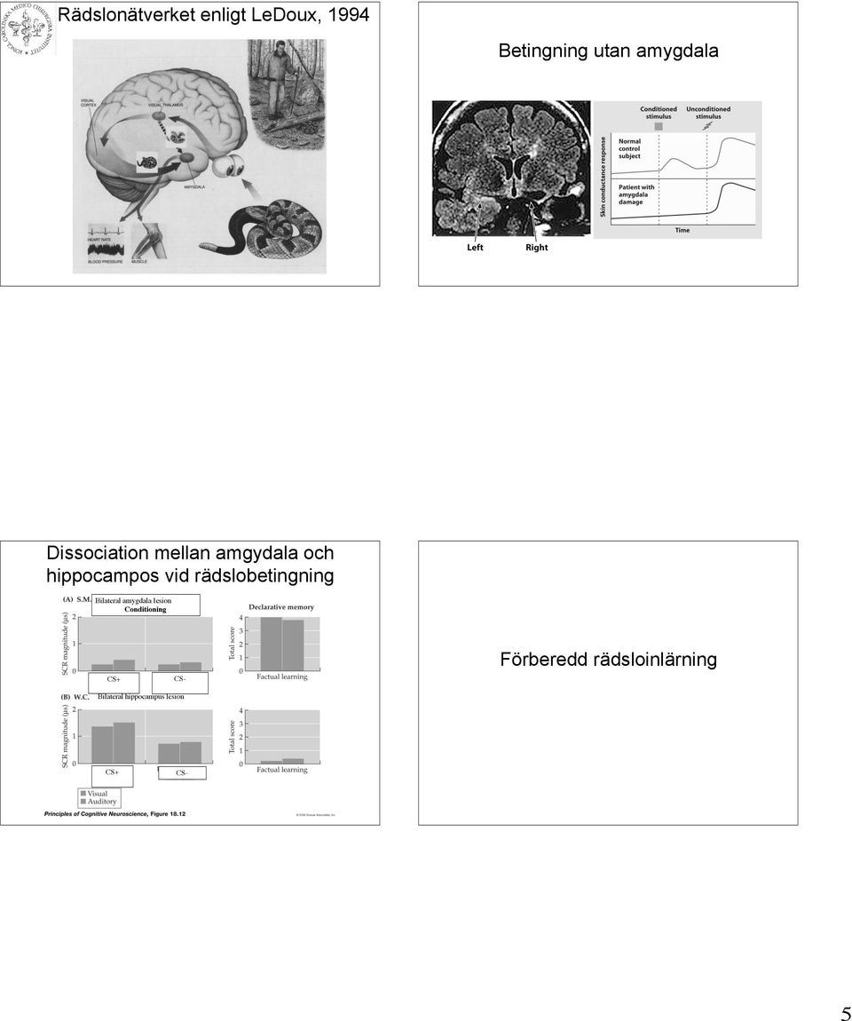 rädslobetingning Bilateral amygdala lesion Conditioning CS+