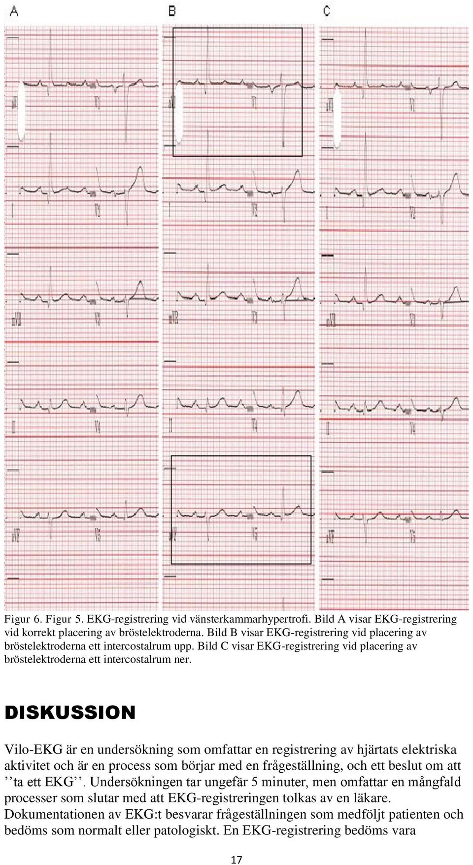 DISKUSSION Vilo-EKG är en undersökning som omfattar en registrering av hjärtats elektriska aktivitet och är en process som börjar med en frågeställning, och ett beslut om att ta ett EKG.