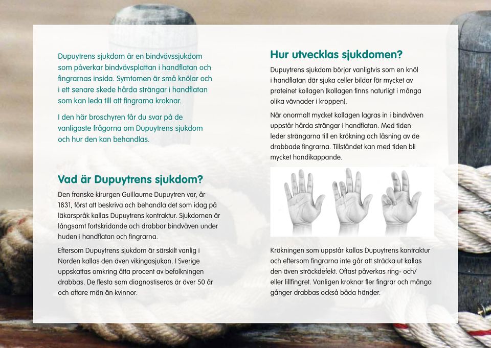 I den här broschyren får du svar på de vanligaste frågorna om Dupuytrens sjukdom och hur den kan behandlas. Hur utvecklas sjukdomen?