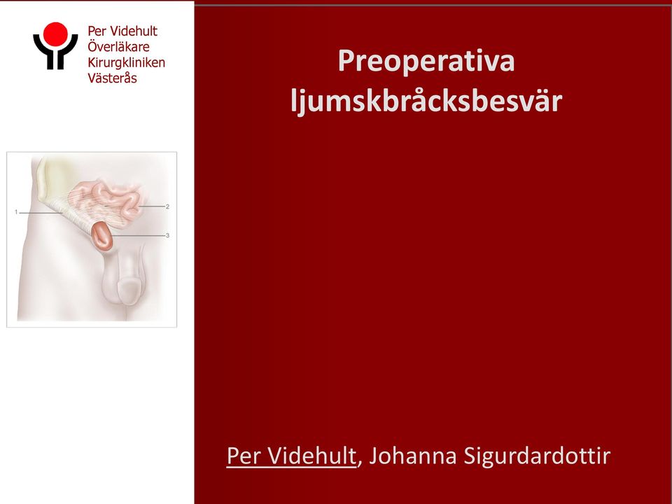 Preoperativa