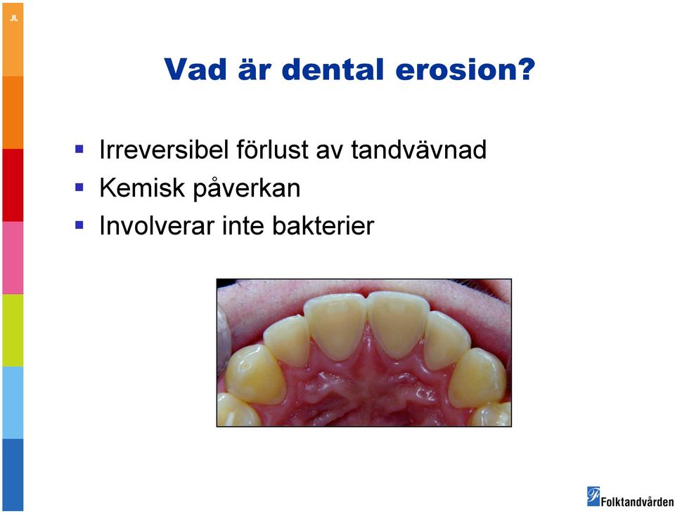 tandvävnad Kemisk