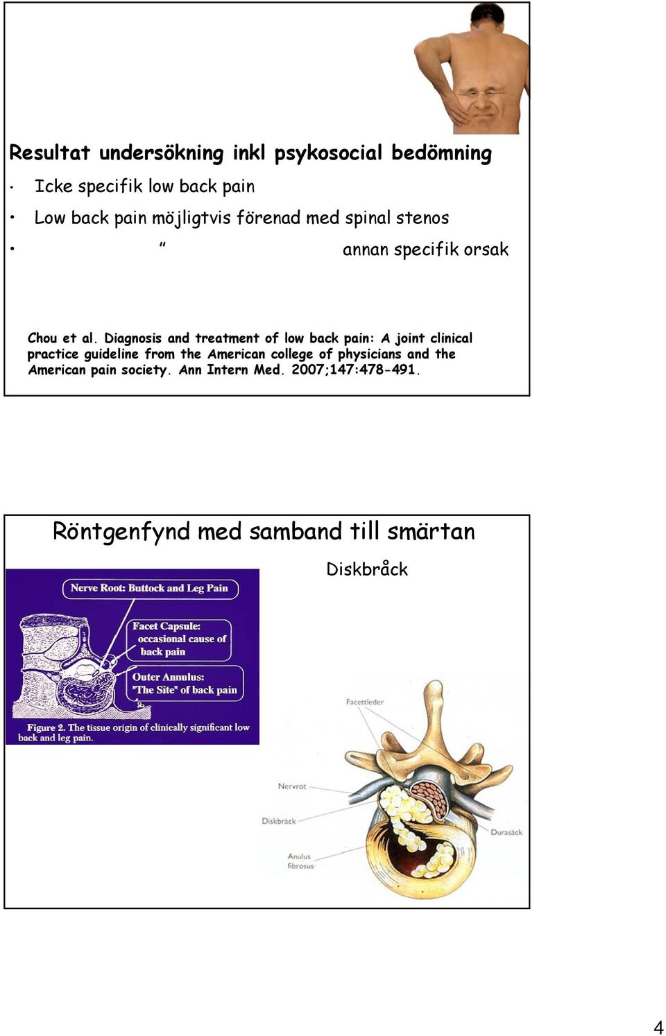 Diagnosis and treatment of low back pain: A joint clinical practice guideline from the American