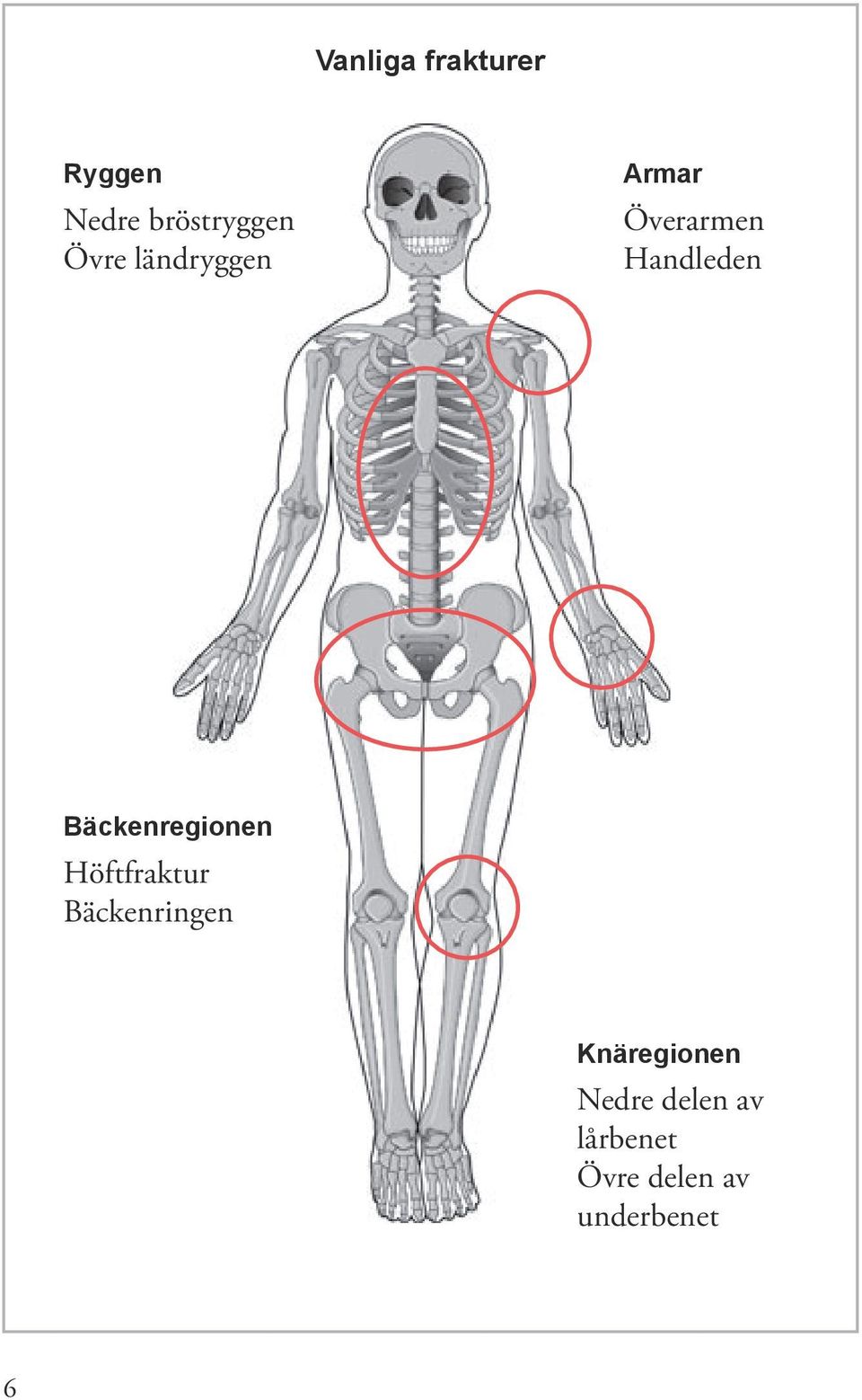 Bäckenregionen Höftfraktur Bäckenringen