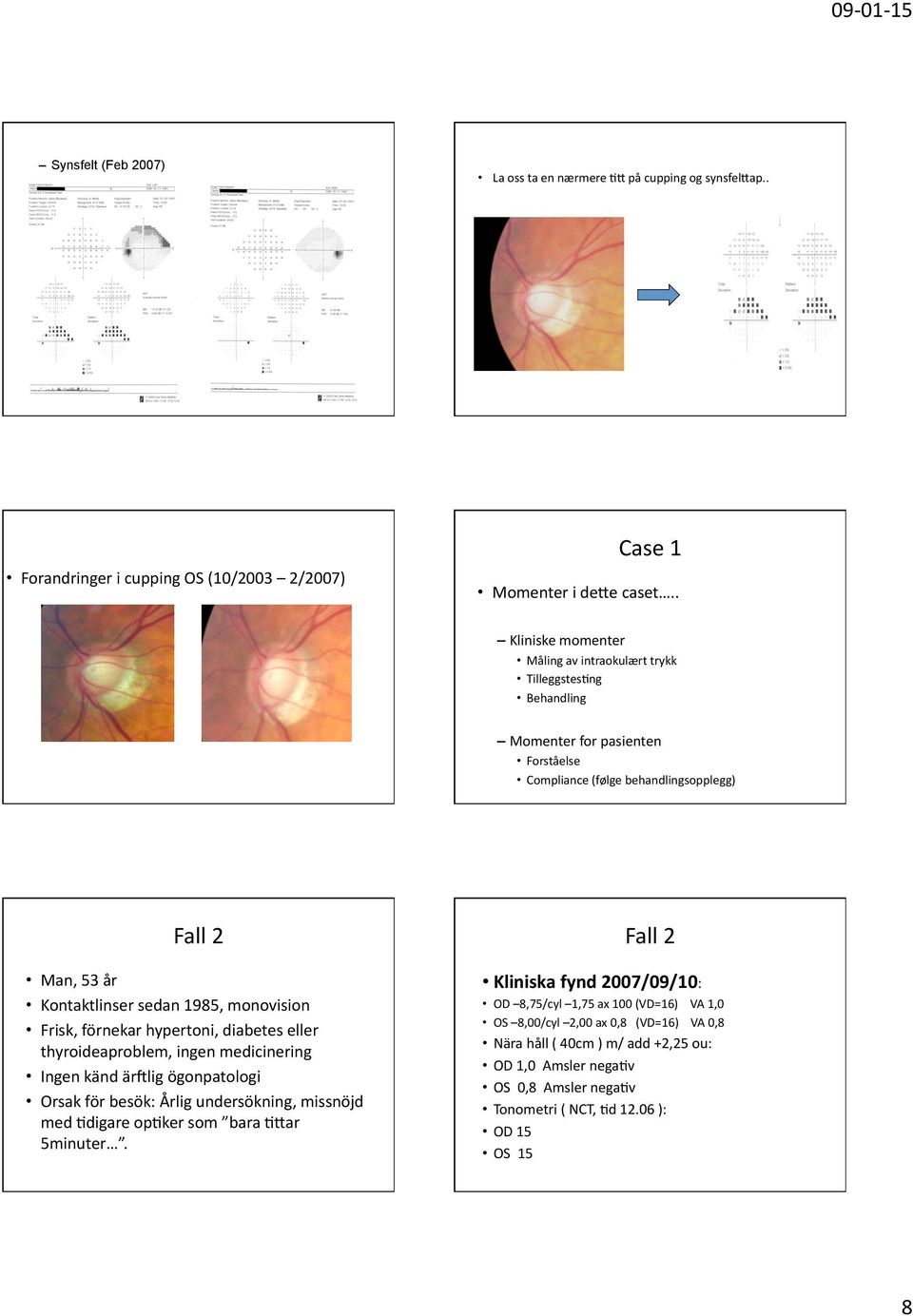 Kontaktlinsersedan1985,monovision Frisk,förnekarhypertoni,diabeteseller thyroideaproblem,ingenmedicinering Ingenkändärrligögonpatologi Orsakförbesök:Årligundersökning,missnöjd