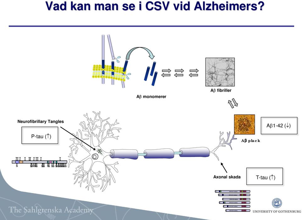 plack T T T T T T T T T T S S S S S S S S S S S S S Axonal skada T-tau ( )