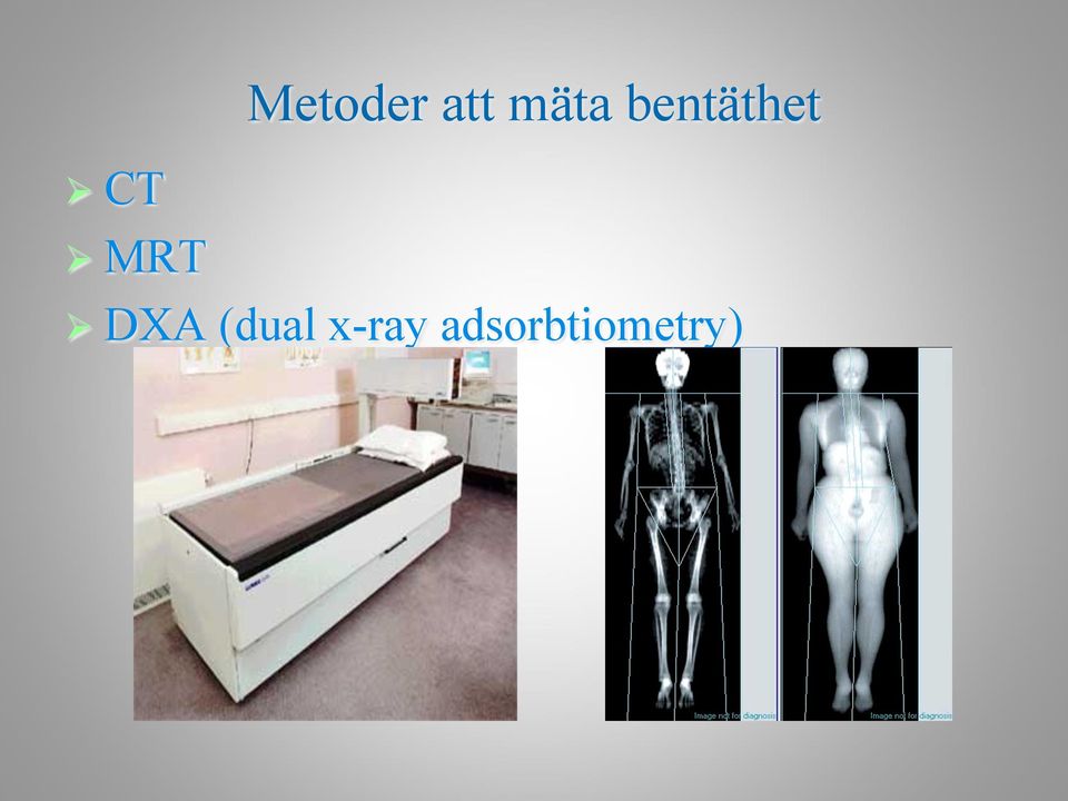 MRT! DXA (dual