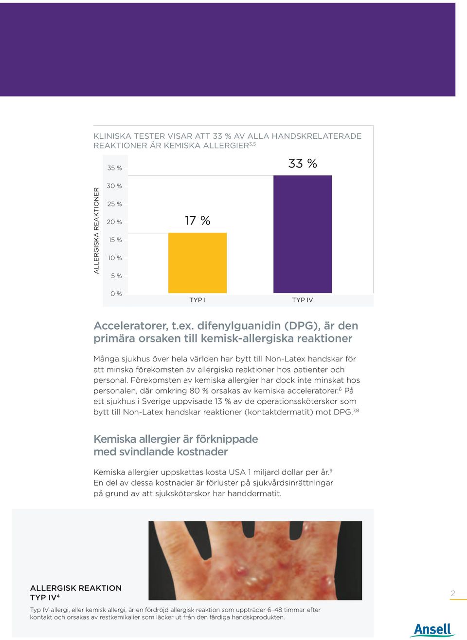 hos patienter och personal. Förekomsten av kemiska allergier har dock inte minskat hos personalen, där omkring 80 % orsakas av kemiska acceleratorer.