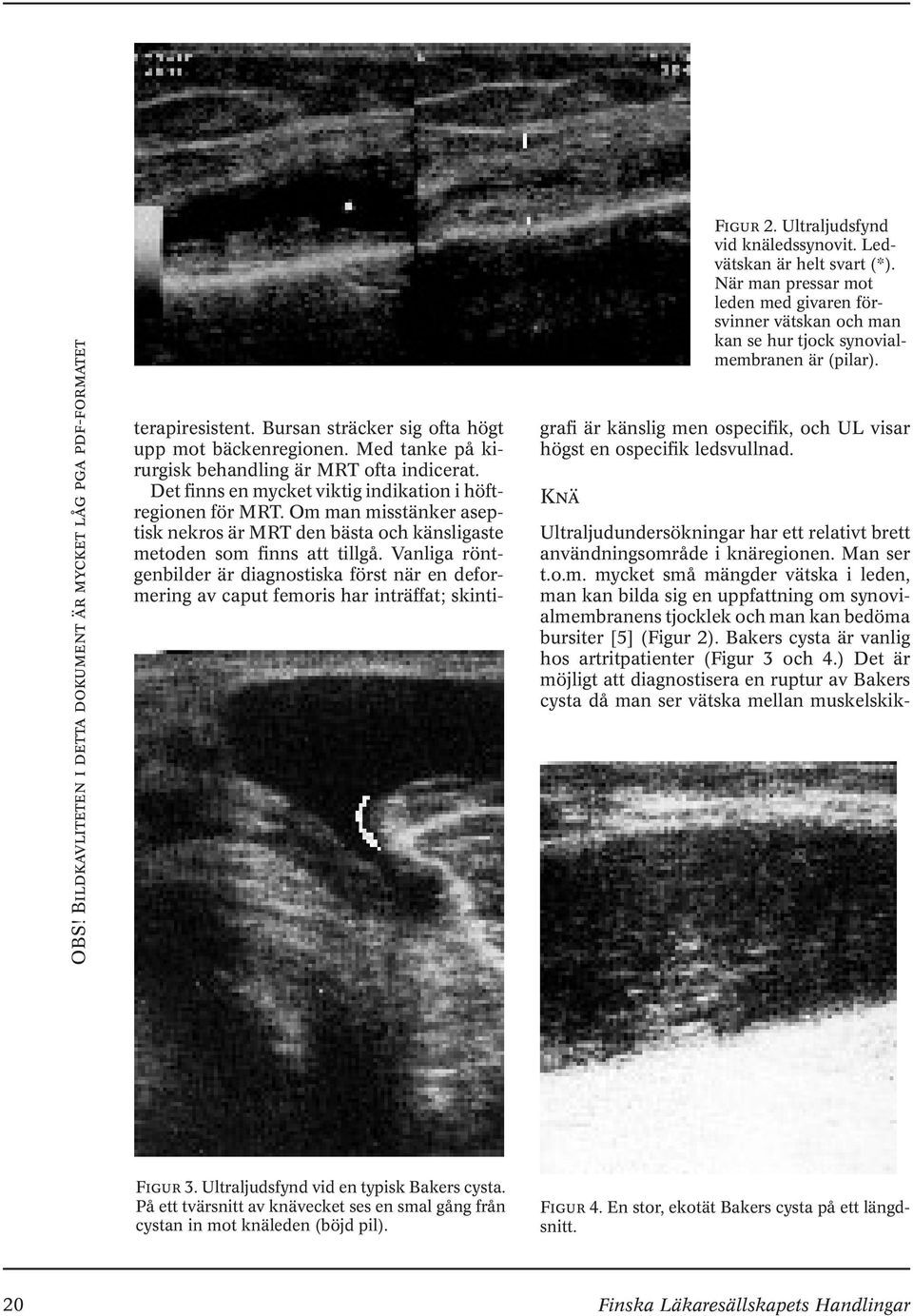 Vanliga röntgenbilder är diagnostiska först när en deformering av caput femoris har inträffat; skintigrafi är känslig men ospecifik, och UL visar högst en ospecifik ledsvullnad. Knä Figur 2.