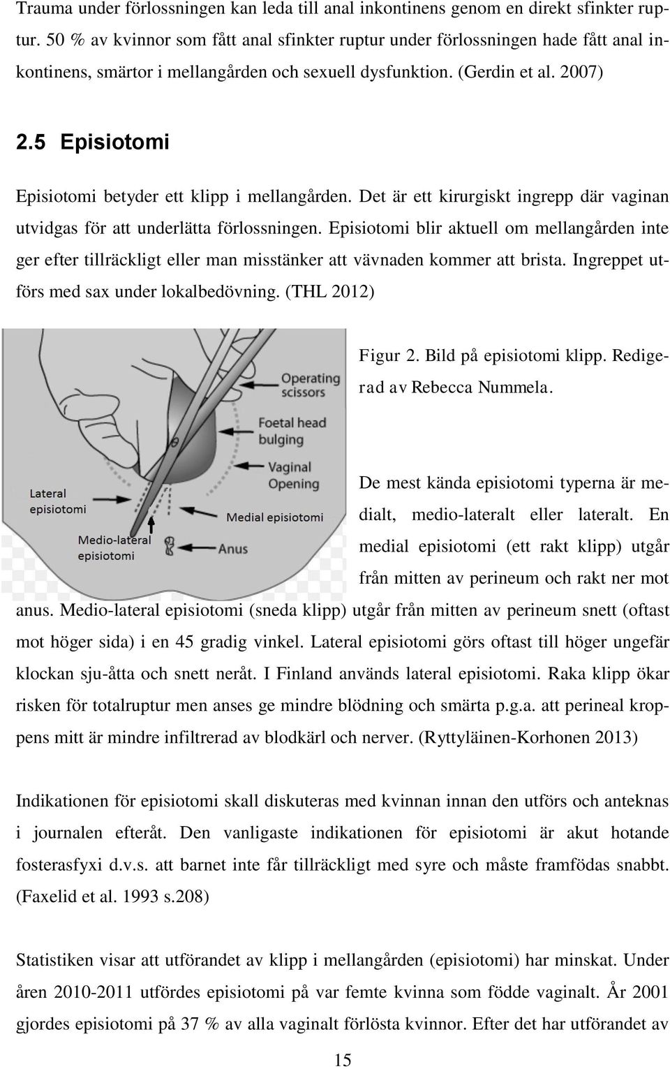 5 Episiotomi Episiotomi betyder ett klipp i mellangården. Det är ett kirurgiskt ingrepp där vaginan utvidgas för att underlätta förlossningen.