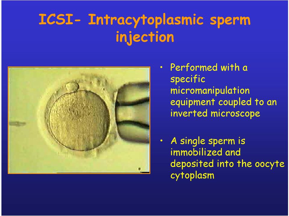 coupled to an inverted microscope A single sperm