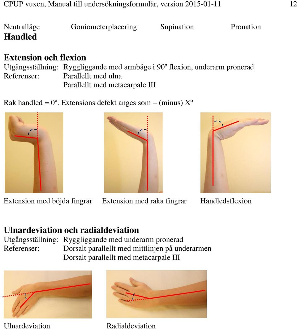 Extensions defekt anges som (minus) Xº Extension med böjda fingrar Extension med raka fingrar Handledsflexion Ulnardeviation och radialdeviation