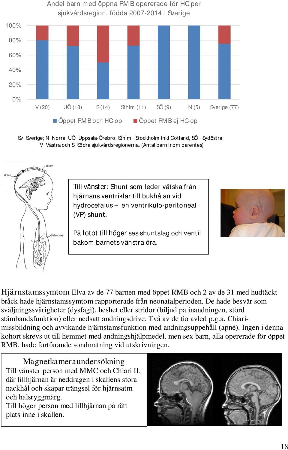 (Antal barn inom parentes) Till vänster: Shunt som leder vätska från hjärnans ventriklar till bukhålan vid hydrocefalus en ventrikulo-peritoneal (VP) shunt.