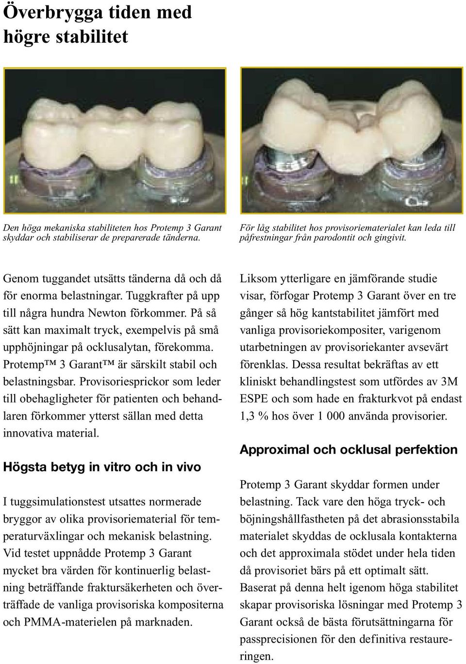 Tuggkrafter på upp till några hundra Newton förkommer. På så sätt kan maximalt tryck, exempelvis på små upphöjningar på ocklusalytan, förekomma. Protemp 3 Garant är särskilt stabil och belastningsbar.