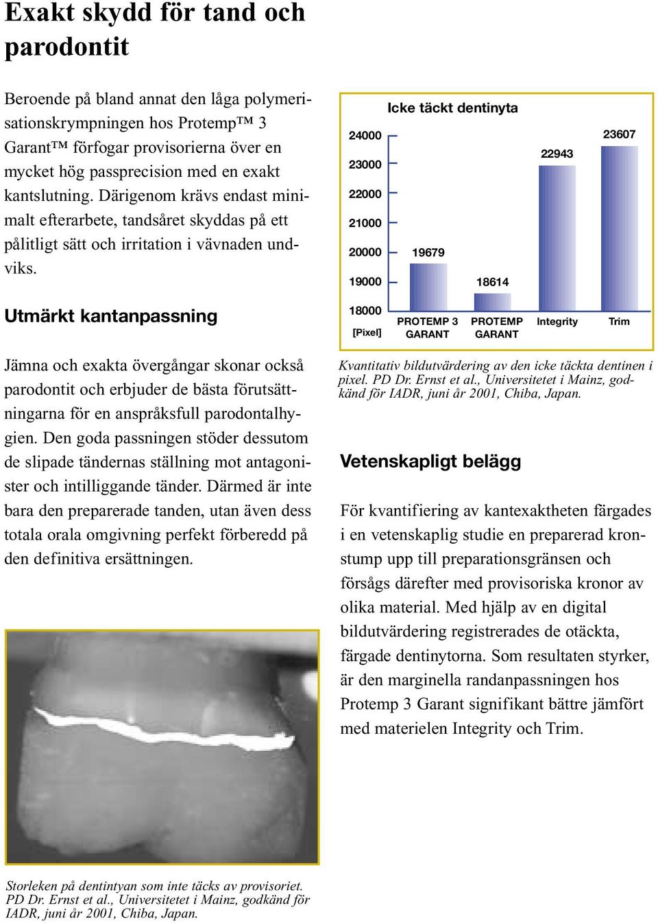 Icke täckt dentinyta 24000 23000 22000 21000 20000 19679 19000 18614 22943 23607 Utmärkt kantanpassning 18000 [Pixel] PROTEMP 3 GARANT PROTEMP GARANT Integrity Trim Jämna och exakta övergångar skonar