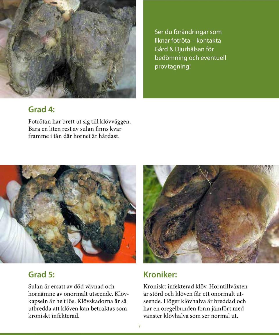 Grad 5: Sulan är ersatt av död vävnad och hornämne av onormalt utseende. Klövkapseln är helt lös.