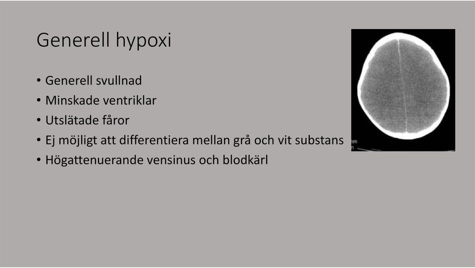 möjligt att differentiera mellan grå och