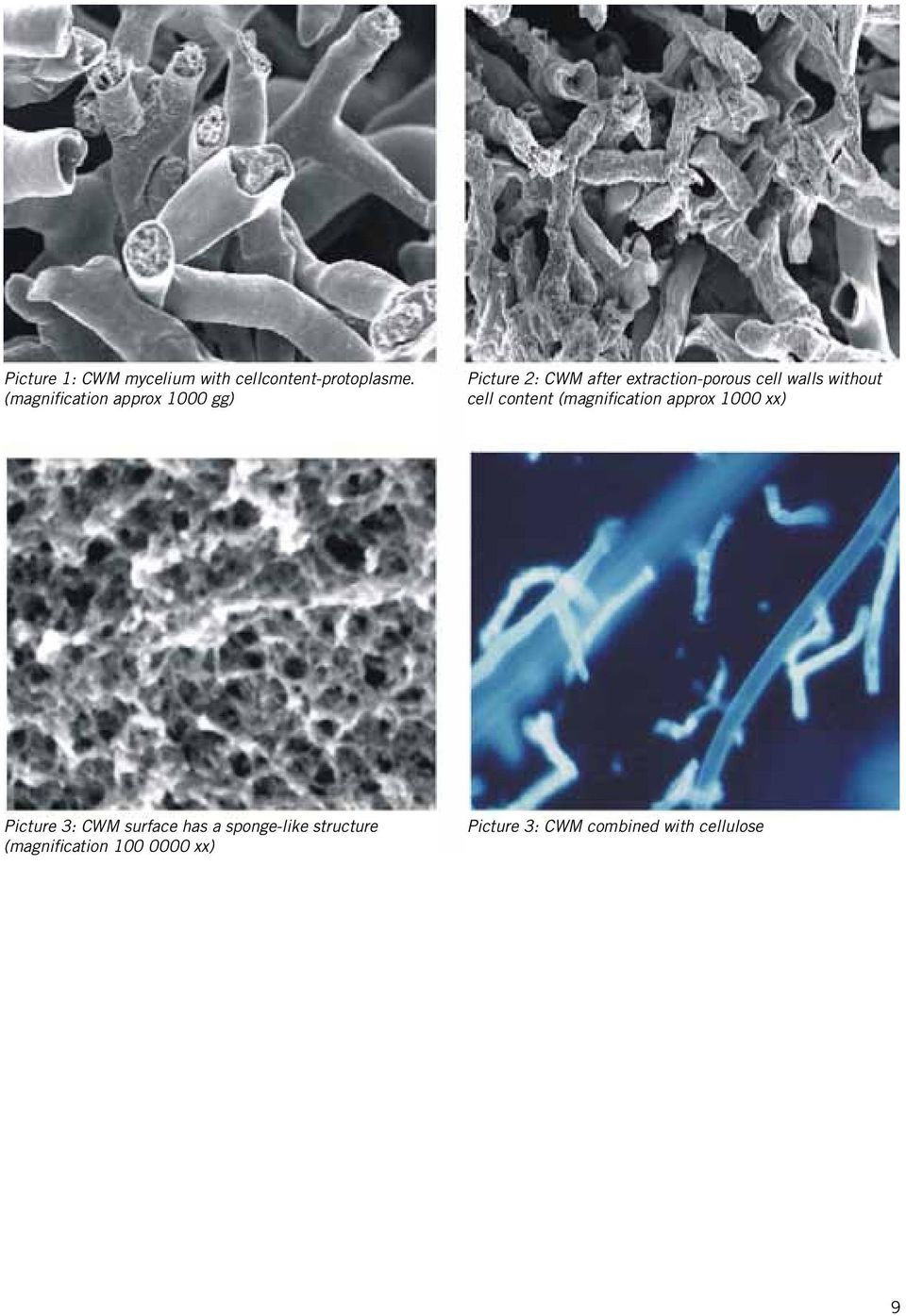 walls without cell content (magnification approx 1000 xx) Picture 3: CWM