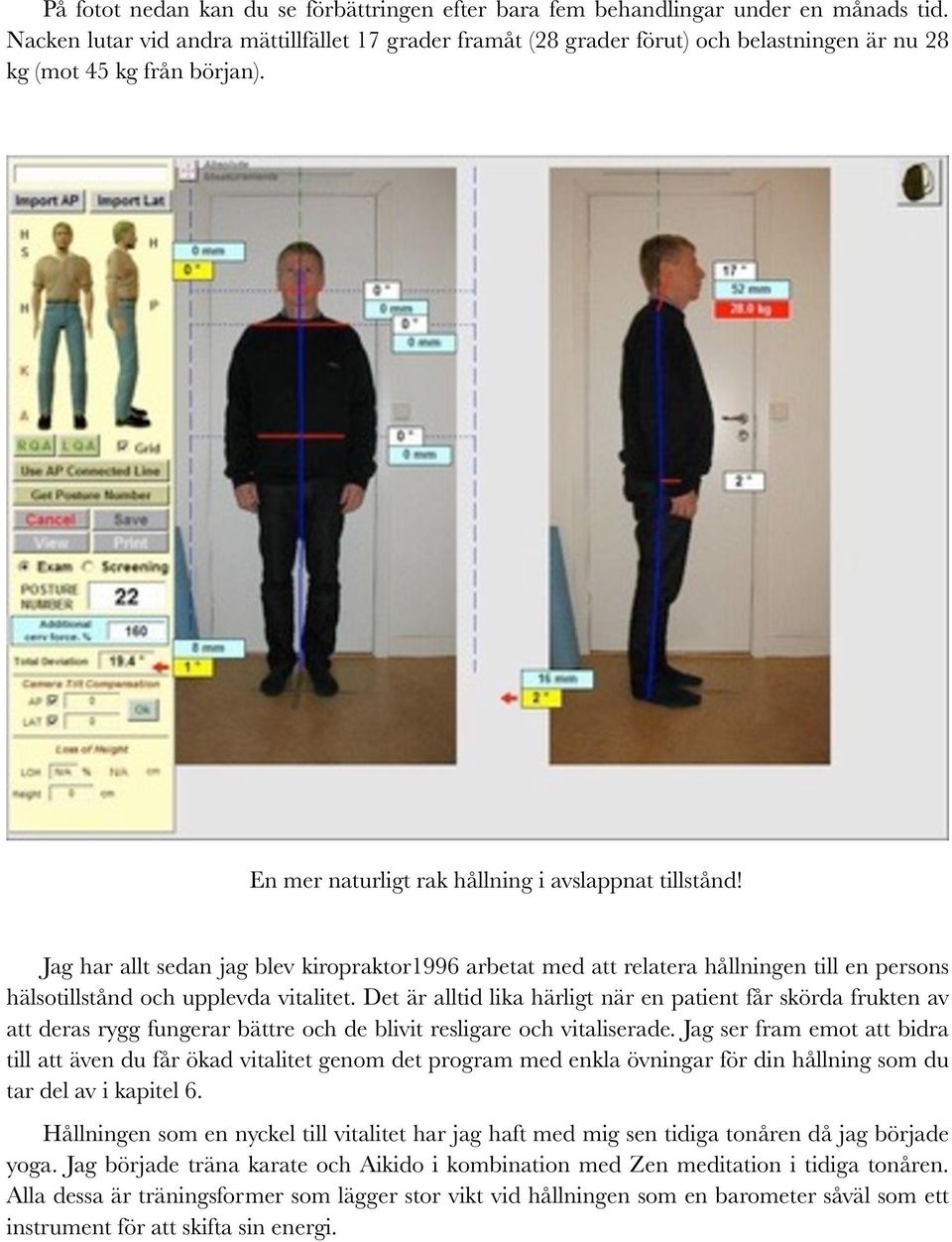 Jag har allt sedan jag blev kiropraktor1996 arbetat med att relatera hållningen till en persons hälsotillstånd och upplevda vitalitet.