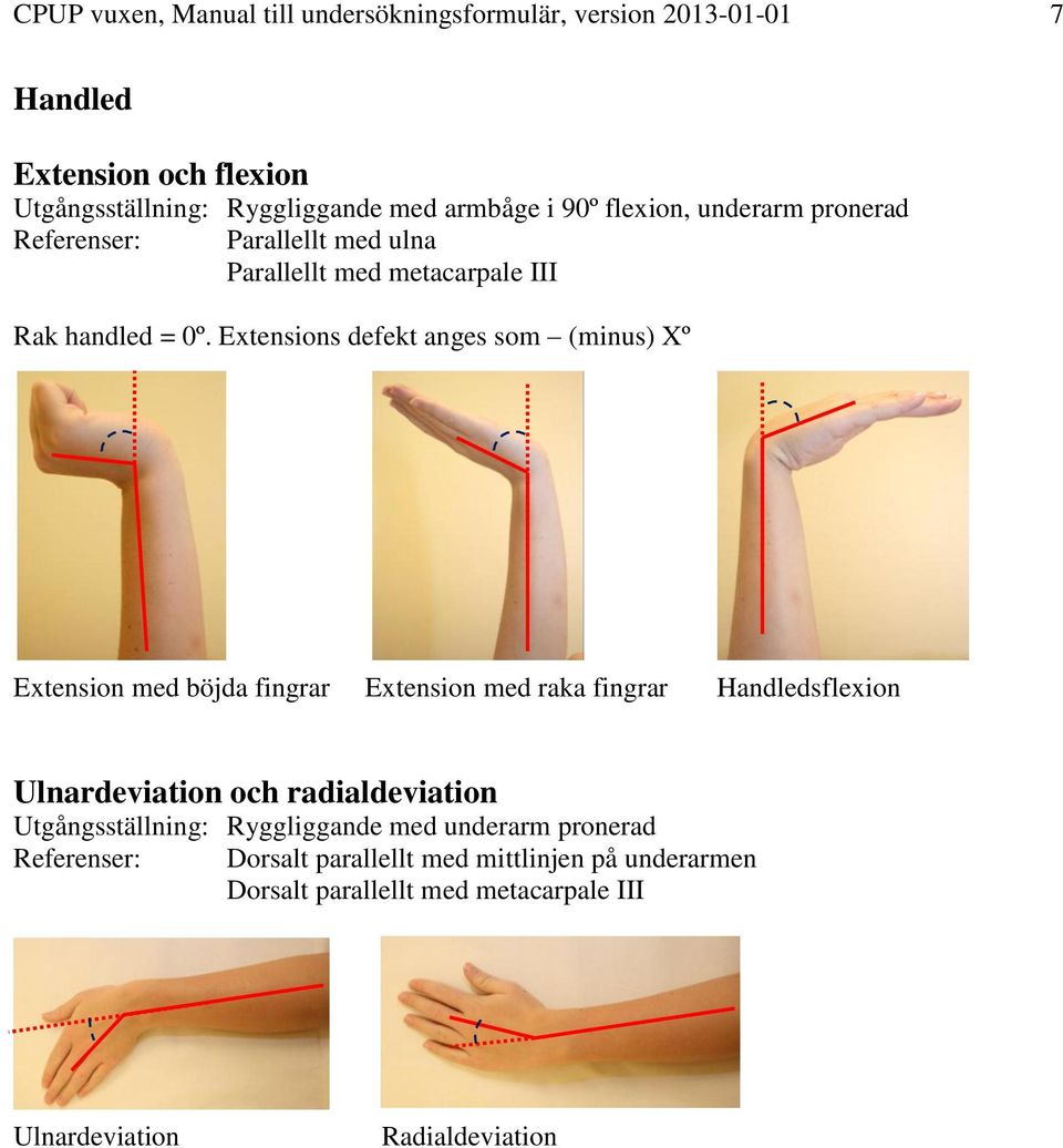 Extensions defekt anges som (minus) Xº Extension med böjda fingrar Extension med raka fingrar Handledsflexion Ulnardeviation och radialdeviation