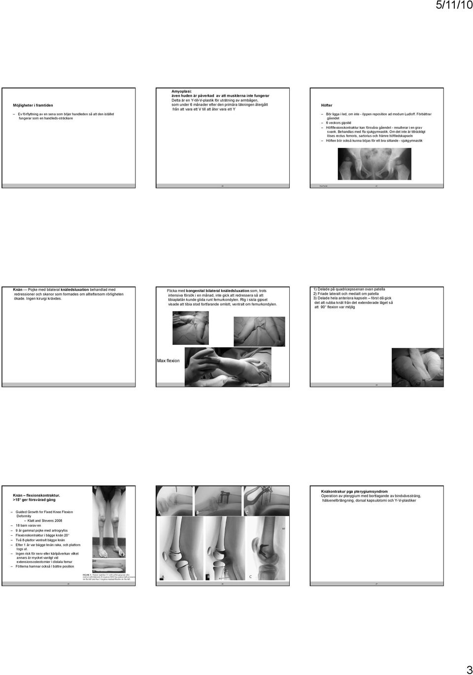 i led, om inte - öppen reposition ad modum Ludloff. Förbättrar gåendet 6 veckors gipstid Höftflexionskontraktur kan försvåra gåendet - resulterar i en grav svank. Behandlas med ffa sjukgymnastik.