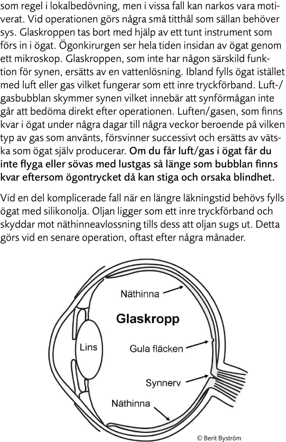 Glaskroppen, som inte har någon särskild funktion för synen, ersätts av en vattenlösning. Ibland fylls ögat istället med luft eller gas vilket fungerar som ett inre tryckförband.