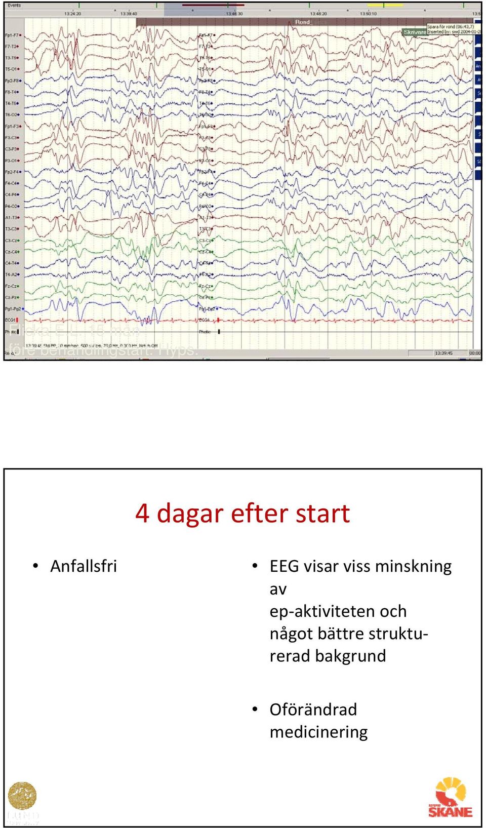 minskning av ep aktiviteten och något bättre