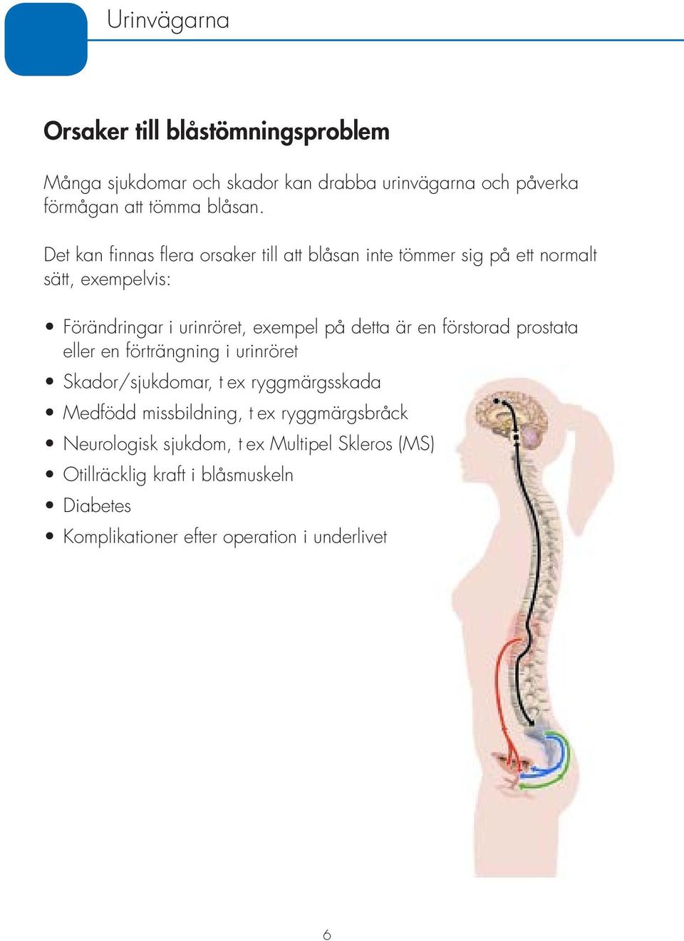 är en förstorad prostata eller en förträngning i urinröret Skador/sjukdomar, t ex ryggmärgsskada Medfödd missbildning, t ex