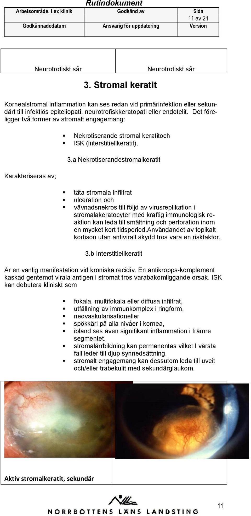 a Nekrtiserandestrmalkeratit täta strmala infiltrat ulceratin ch vävnadsnekrs till följd av virusreplikatin i strmalakeratcyter med kraftig immunlgisk reaktin kan leda till smältning ch perfratin inm