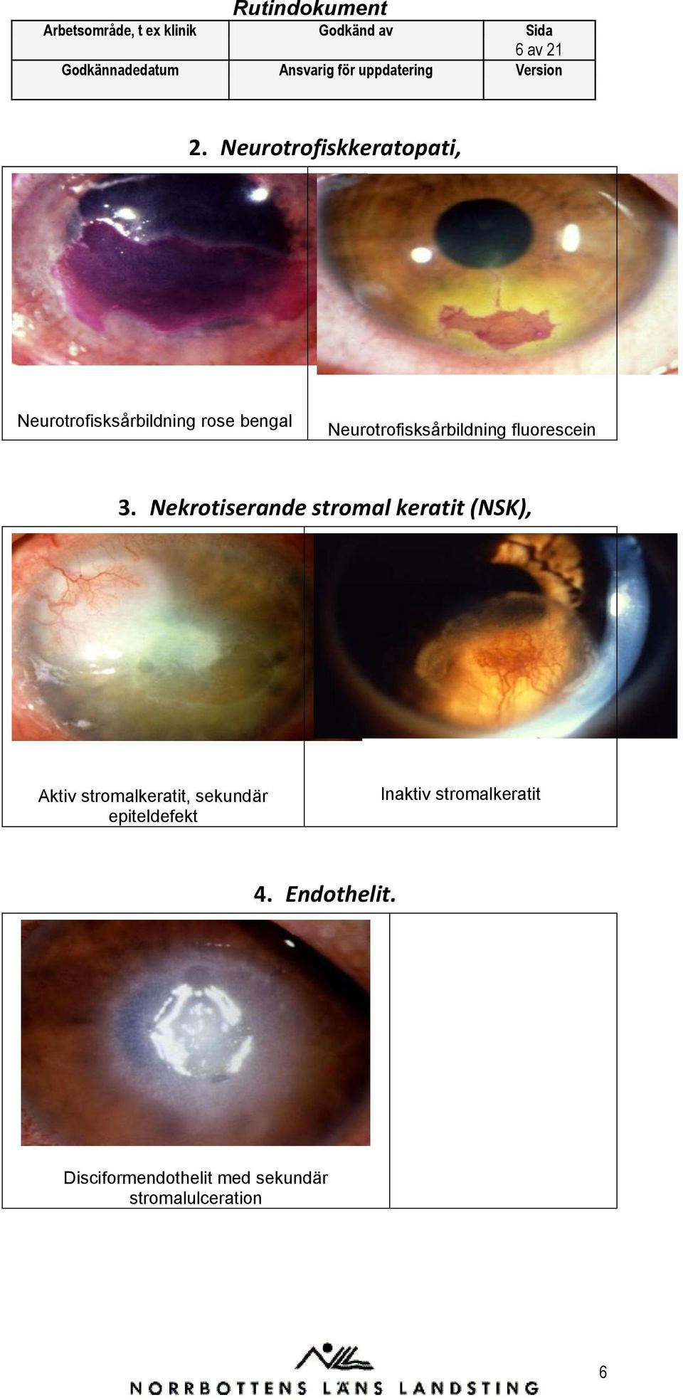 Neurtrfisksårbildning flurescein 3.