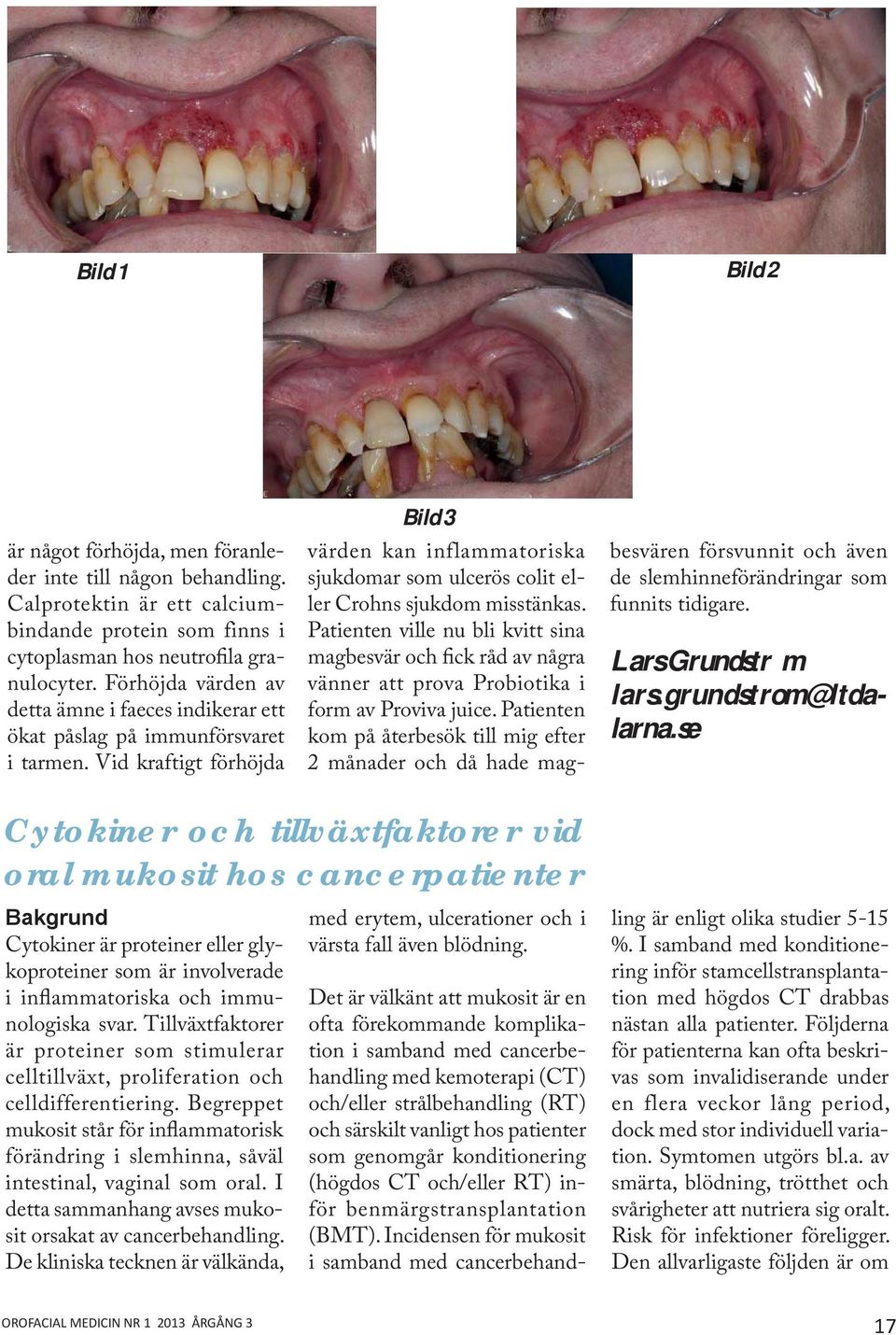 Vid kraftigt förhöjda Bild 3 värden kan inflammatoriska sjukdomar som ulcerös colit eller Crohns sjukdom misstänkas.