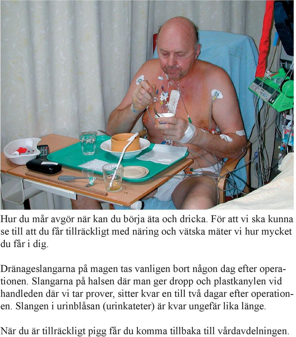 Dränageslangarna på magen tas vanligen bort någon dag efter operationen.