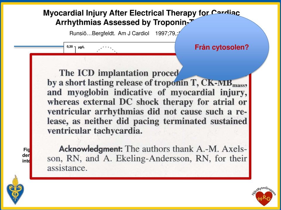 1 S-Troponin T in patients receiving an implantable cardioverter defibrillator.