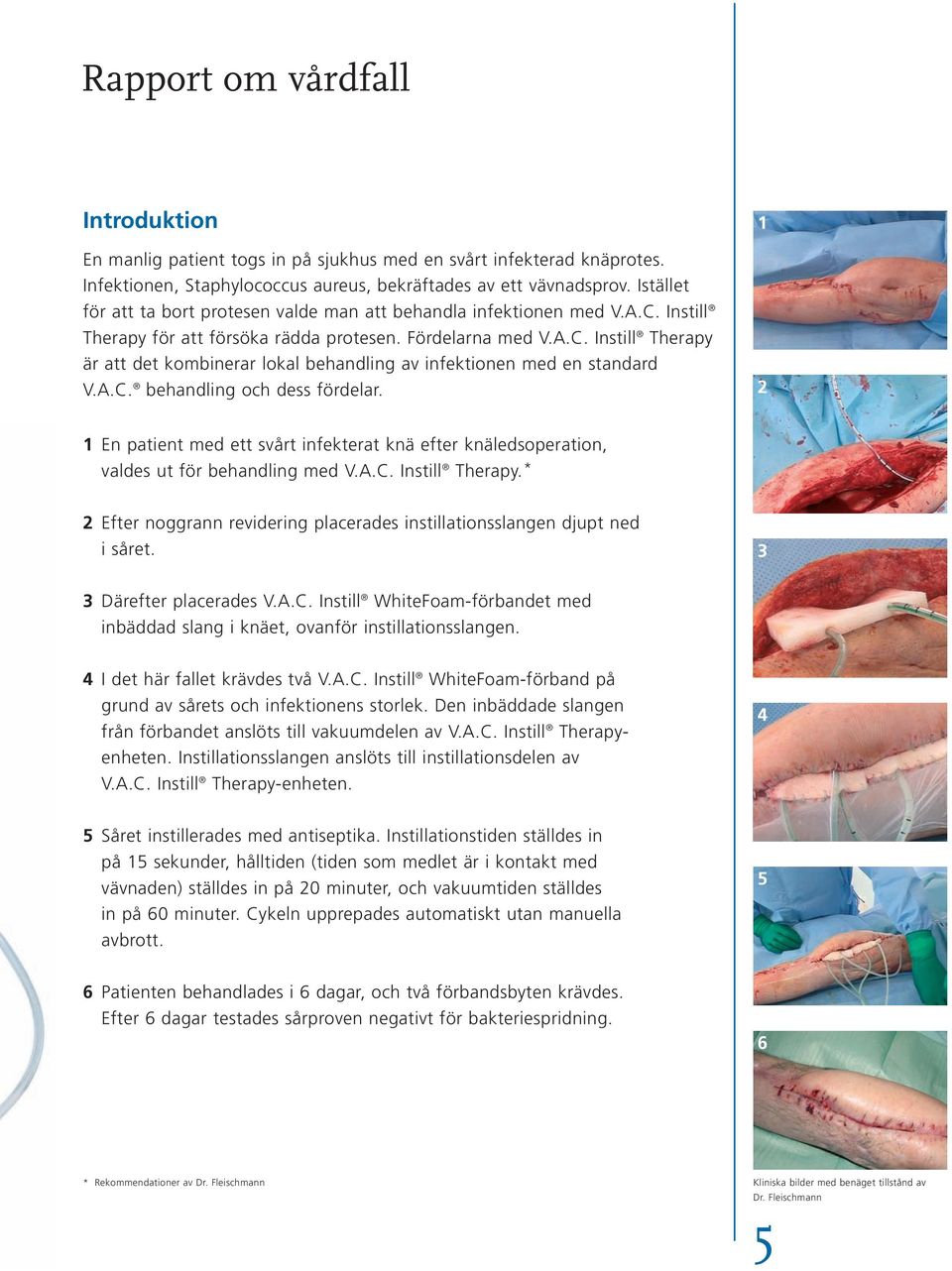 A.C. behandling och dess fördelar. 2 1 En patient med ett svårt infekterat knä efter knäledsoperation, valdes ut för behandling med V.A.C. Instill Therapy.