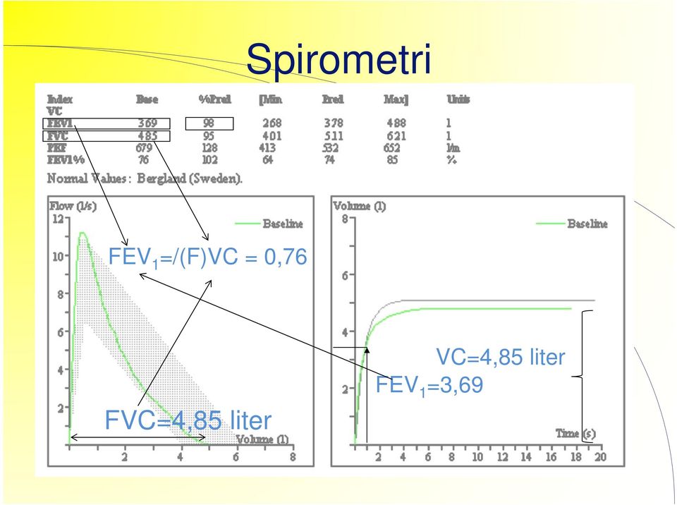 FVC=4,85 liter