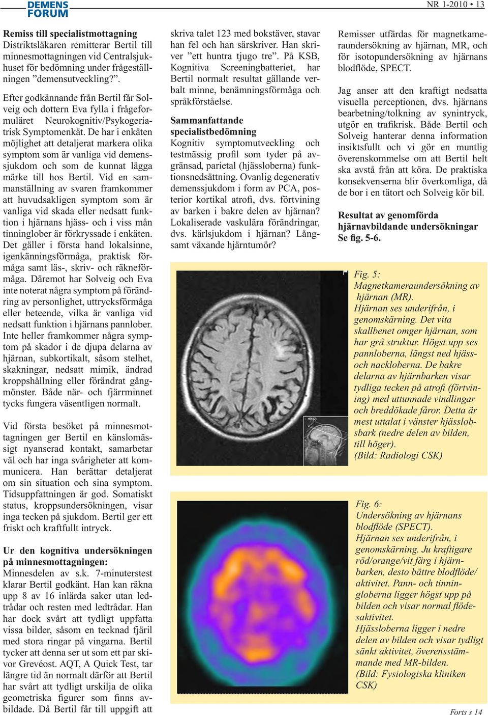 De har i enkäten möjlighet att detaljerat markera olika symptom som är vanliga vid demenssjukdom och som de kunnat lägga märke till hos Bertil.