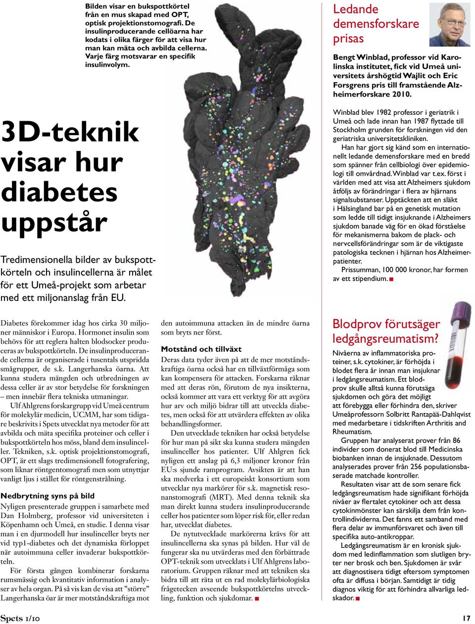 Tredimensionella bilder av bukspottkörteln och insulincellerna är målet för ett Umeå-projekt som arbetar med ett miljonanslag från EU.