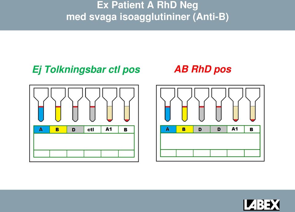 isoagglutininer