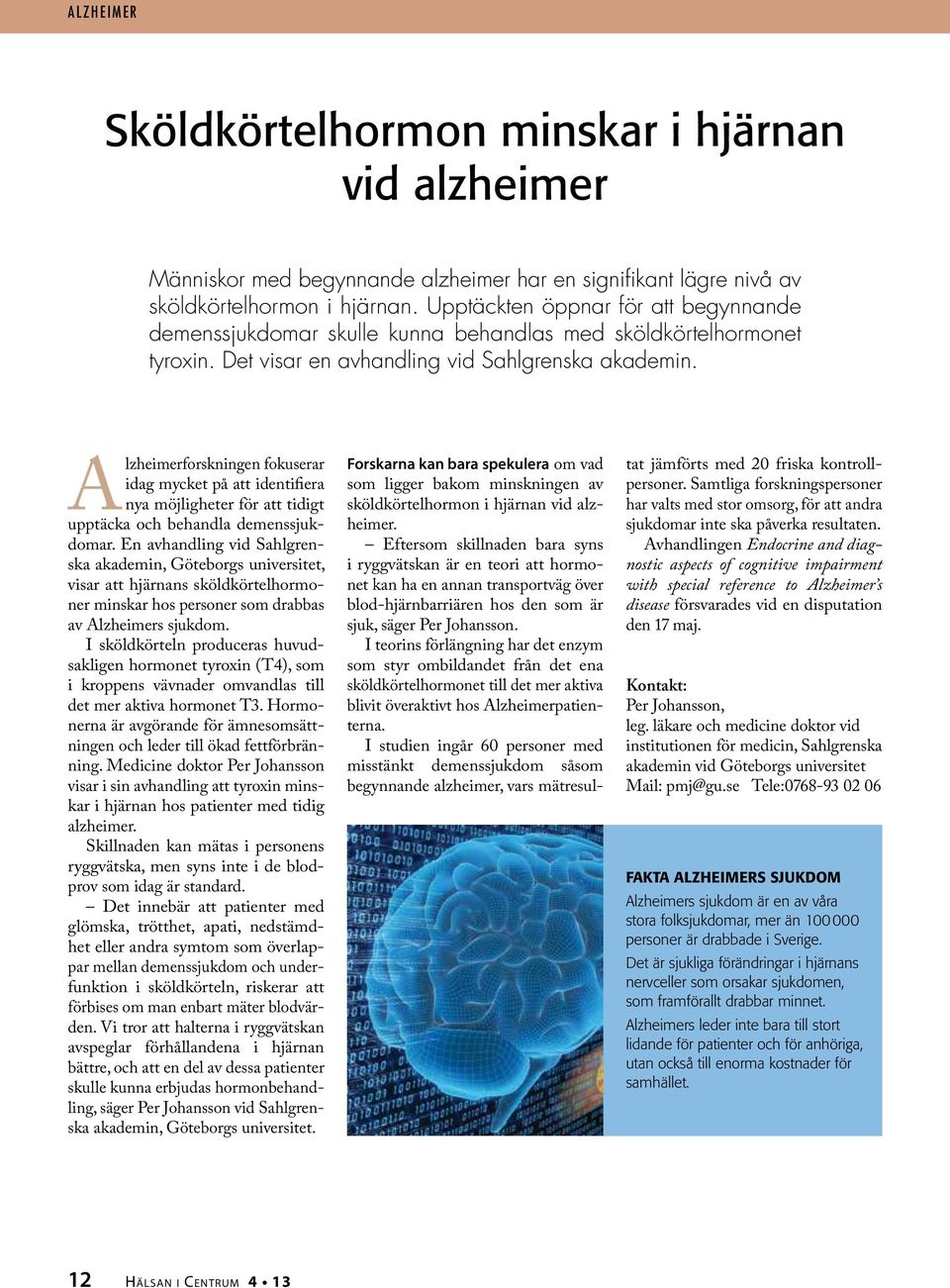 Alzheimerforskningen fokuserar idag mycket på att identifiera nya möjligheter för att tidigt upptäcka och behandla demenssjukdomar.