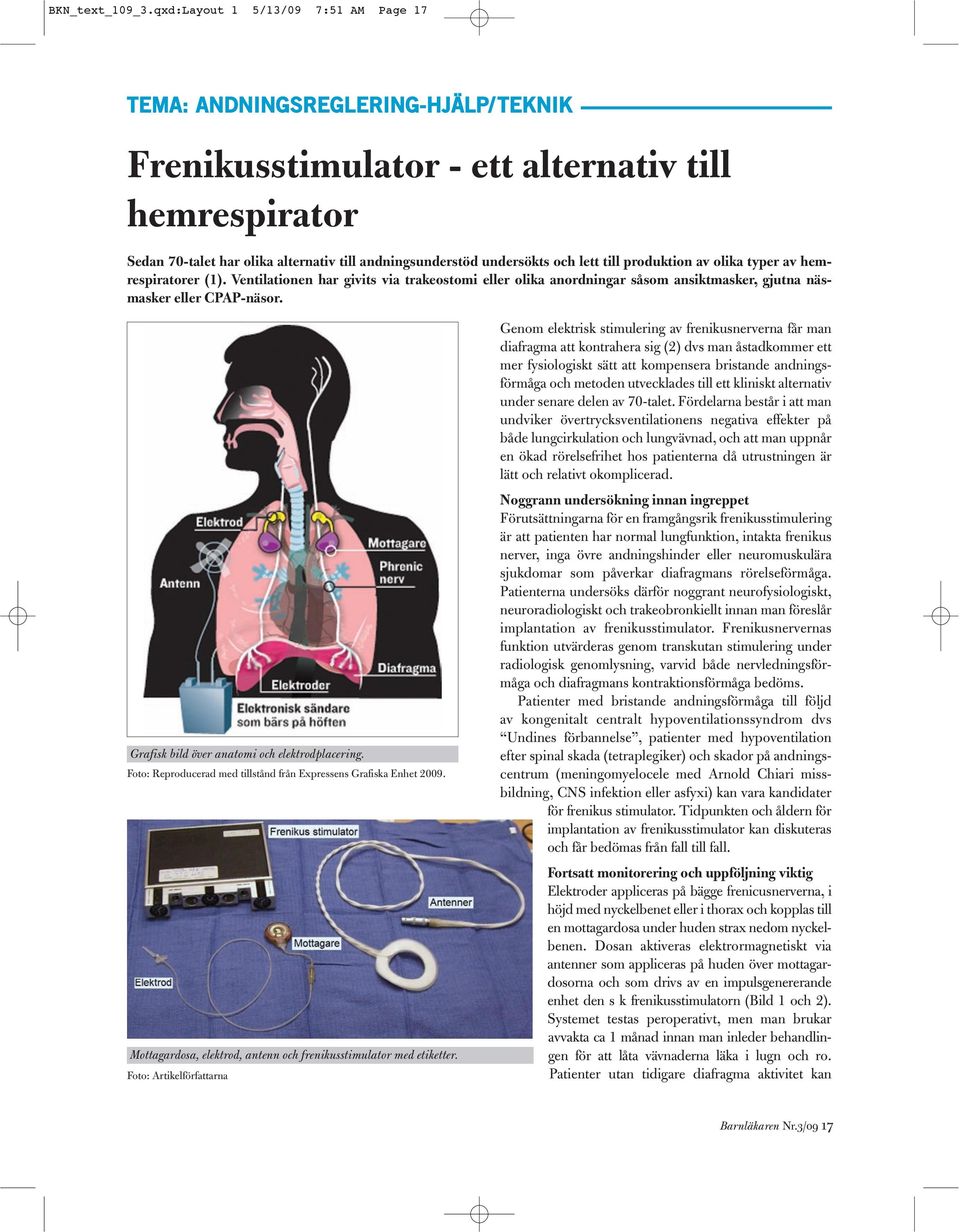 och lett till produktion av olika typer av hemrespiratorer (1). Ventilationen har givits via trakeostomi eller olika anordningar såsom ansiktmasker, gjutna näsmasker eller CPAP-näsor.