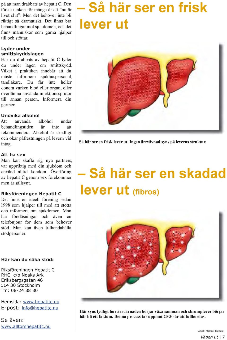 Så här ser en frisk lever ut Lyder under smittskyddslagen Har du drabbats av hepatit C lyder du under lagen om smittskydd.