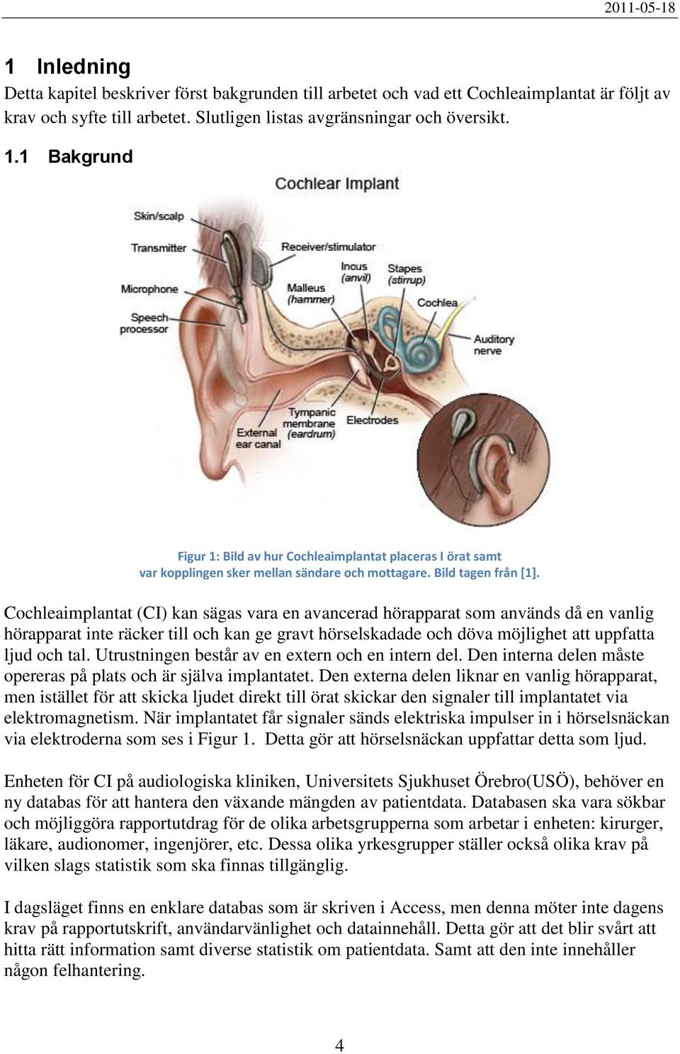 Cochleaimplantat (CI) kan sägas vara en avancerad hörapparat som används då en vanlig hörapparat inte räcker till och kan ge gravt hörselskadade och döva möjlighet att uppfatta ljud och tal.